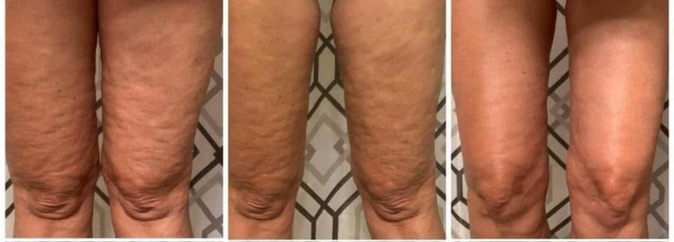 Cellulite/Firming Cream! 3 Pack!