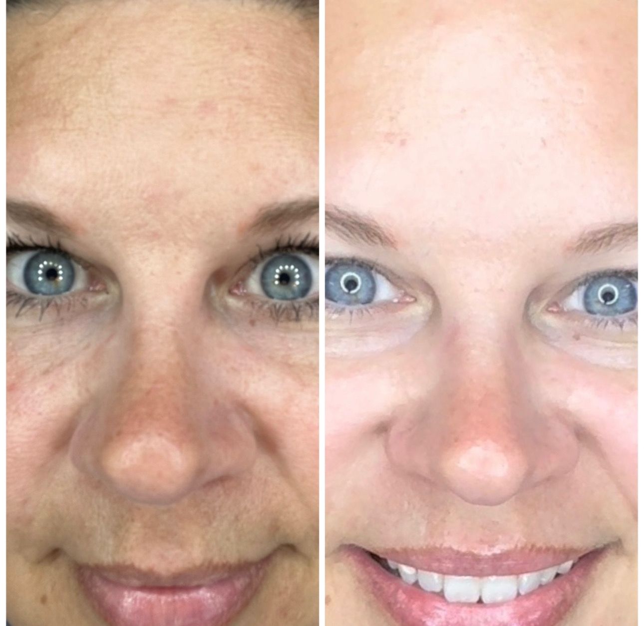 AgeLOC Tru Face Future Serum