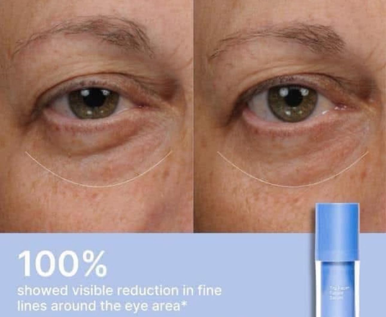 AgeLOC Tru Face Future Serum