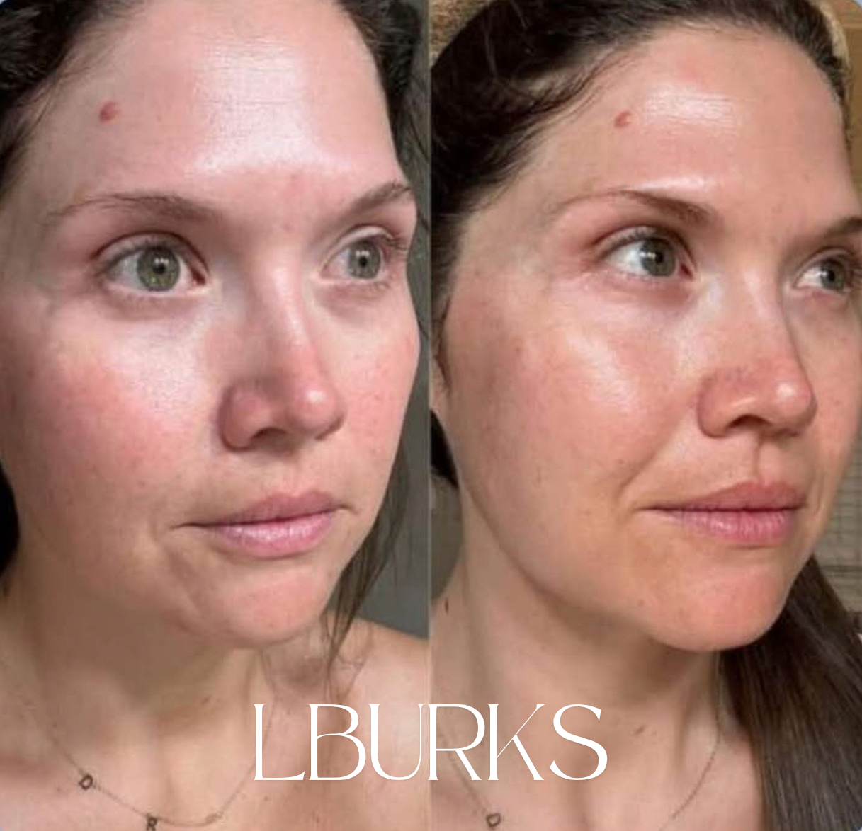 AgeLOC Tru Face Future Serum