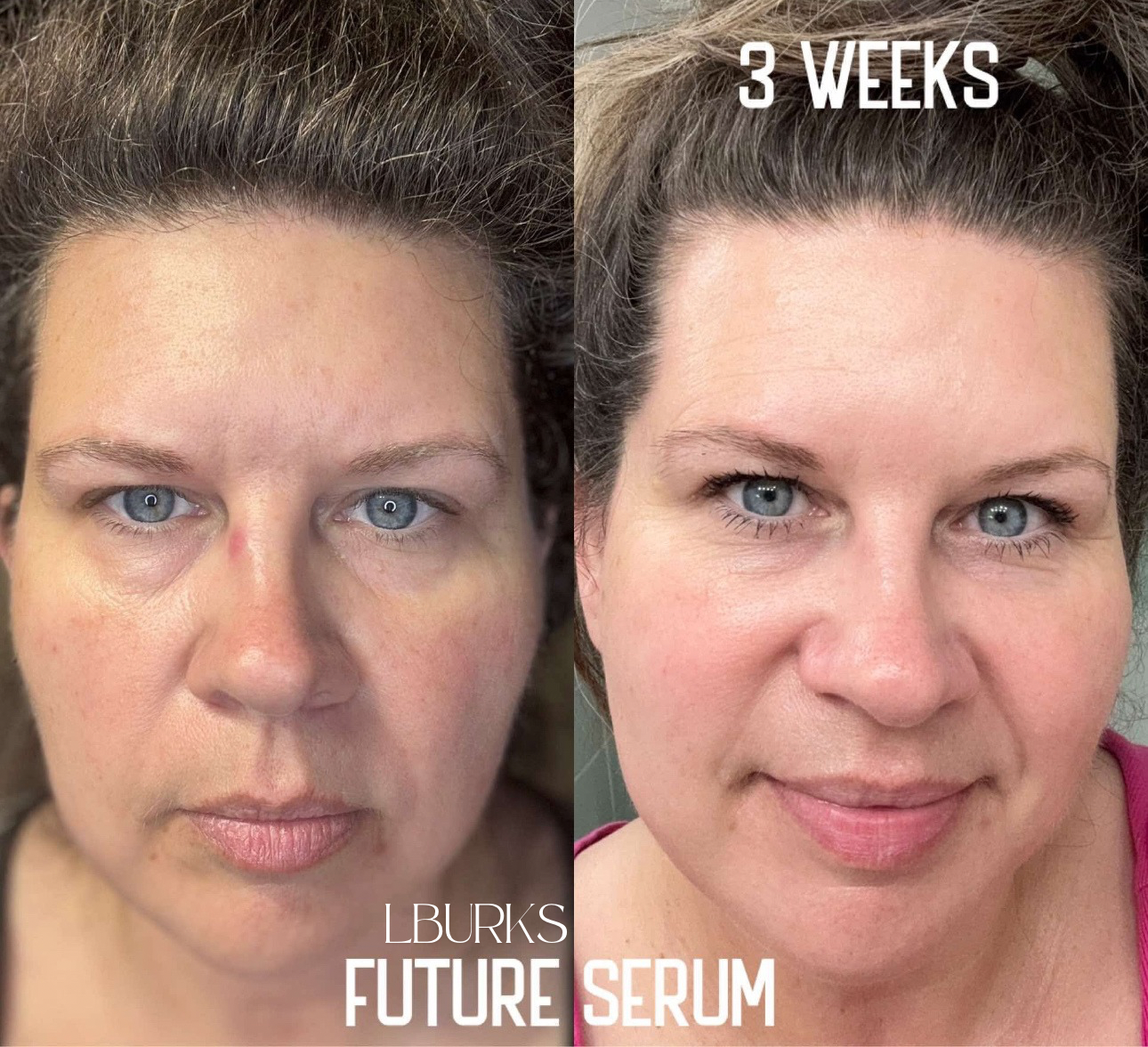 AgeLOC Tru Face Future Serum