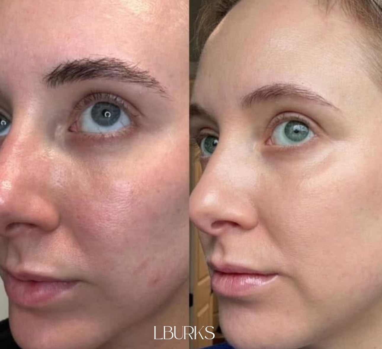 AgeLOC Tru Face Future Serum