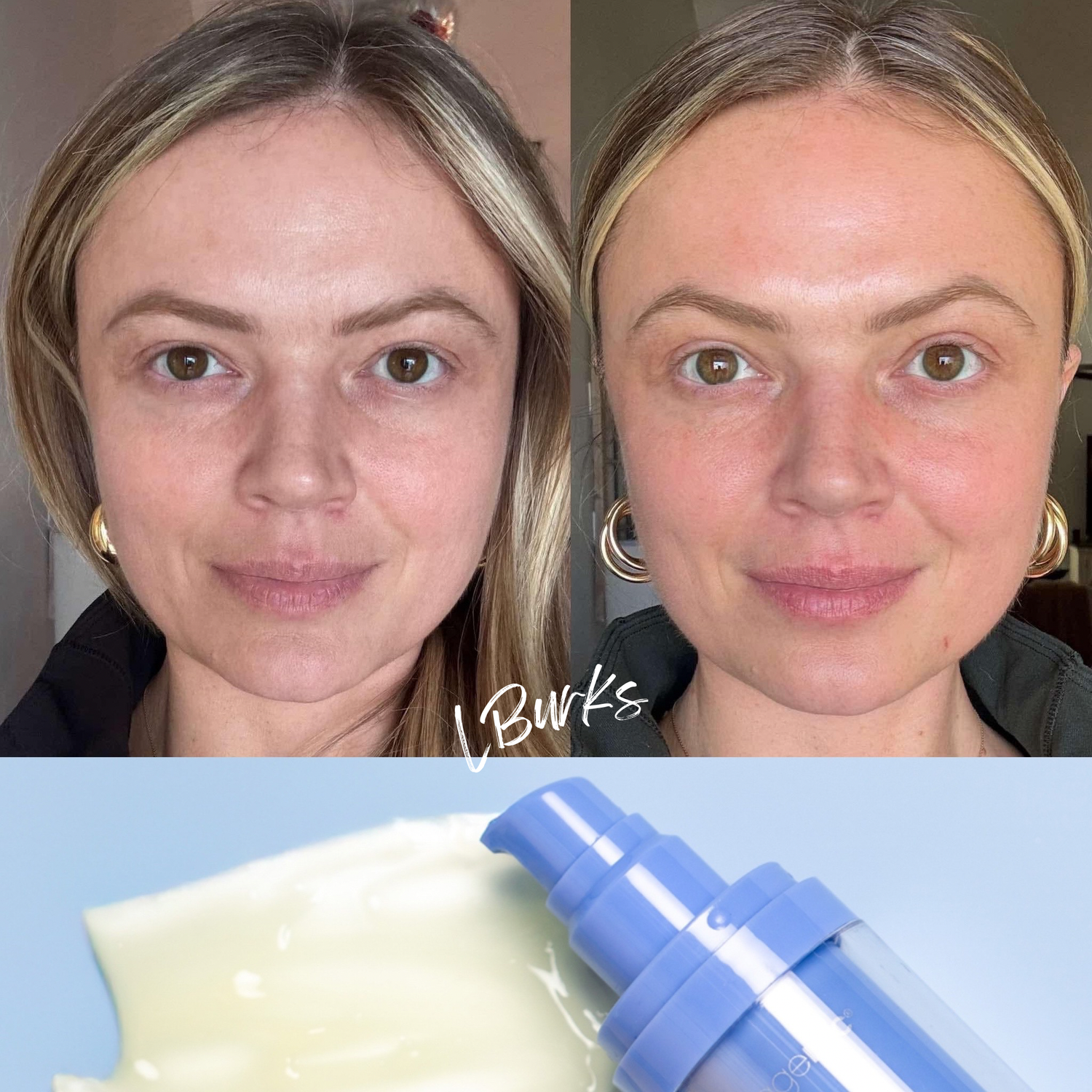 AgeLOC Tru Face Future Serum