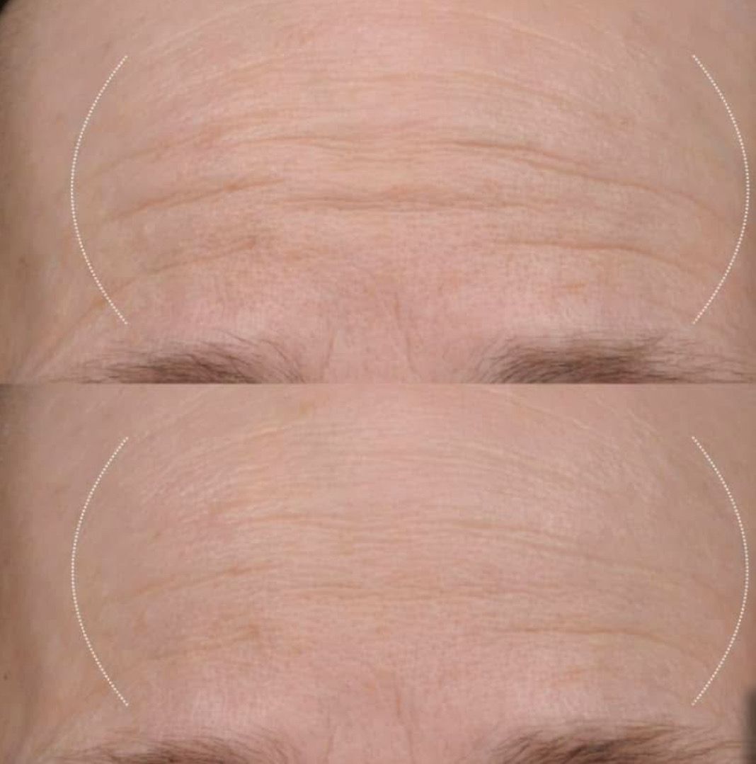 AgeLOC Tru Face Future Serum