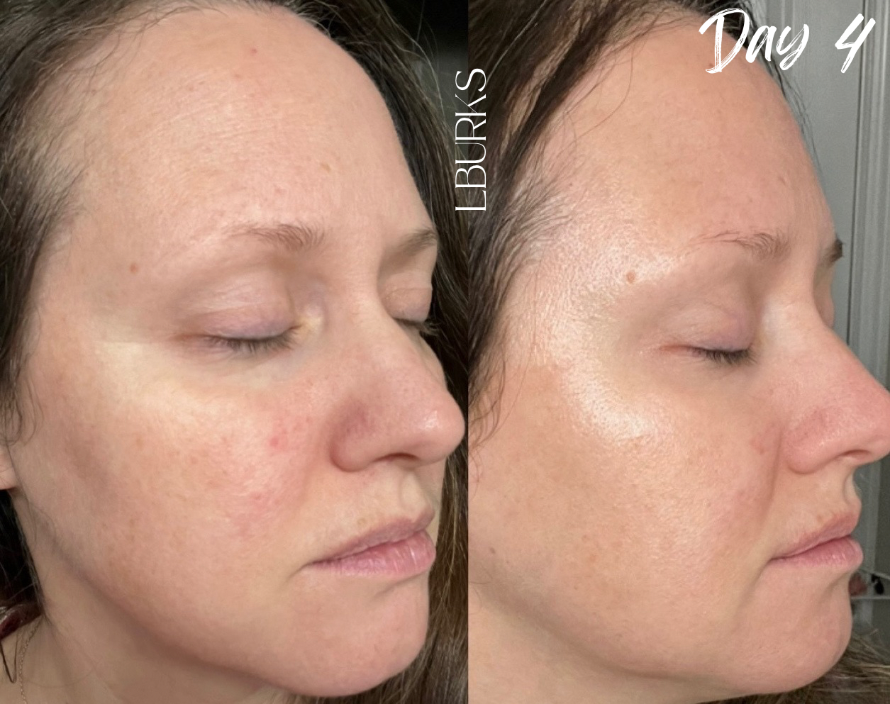 AgeLOC Tru Face Future Serum