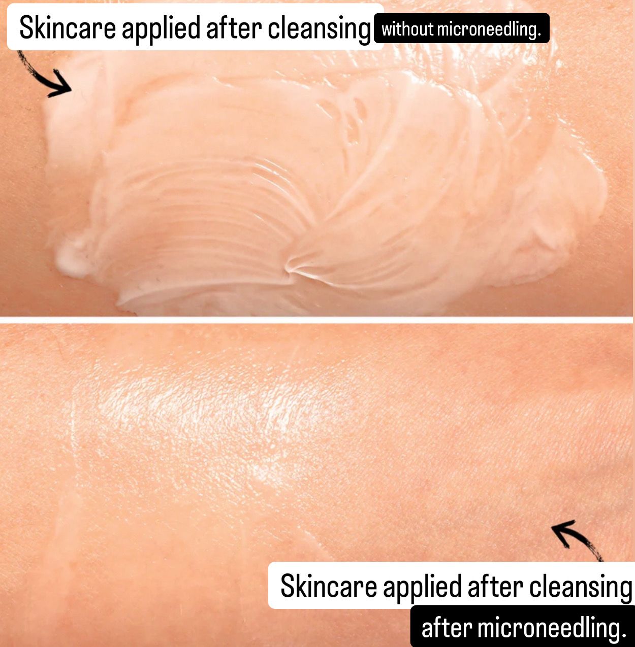 RED LIGHT THERAPY/MICRONEEDLING TOOL + Line Corrector + FREE Full Sized Tanner &amp; Detox Mask Samples