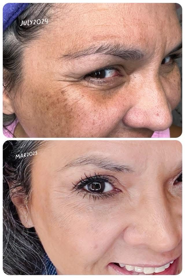 RED LIGHT THERAPY/MICRONEEDLING TOOL + Line Corrector + FREE Full Sized Tanner &amp; Detox Mask Samples