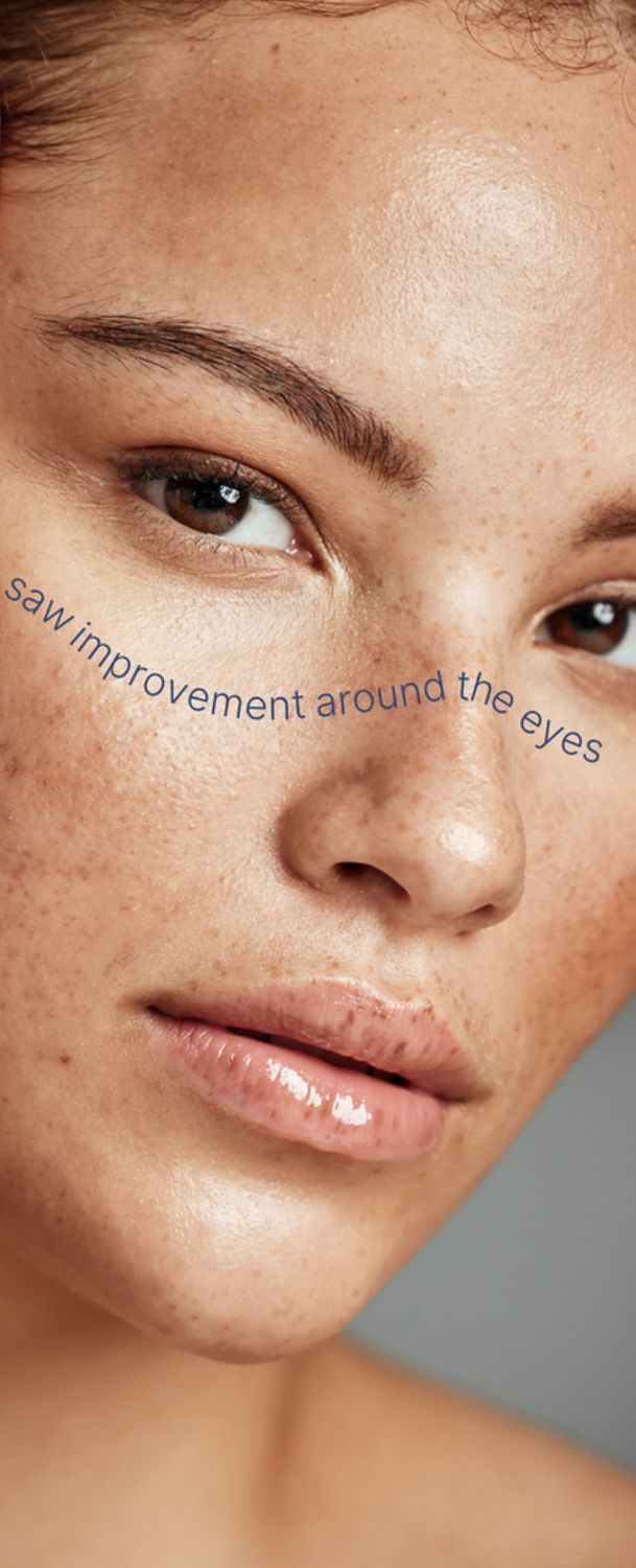 Tru Face Line Corrector