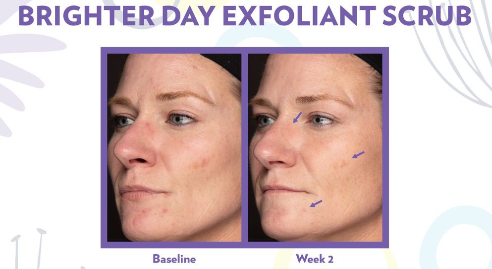 Brighter Day Exfoliant Scrub