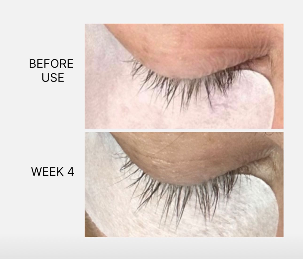 Lash/Brow Serum &amp; Recovery+ Bundle