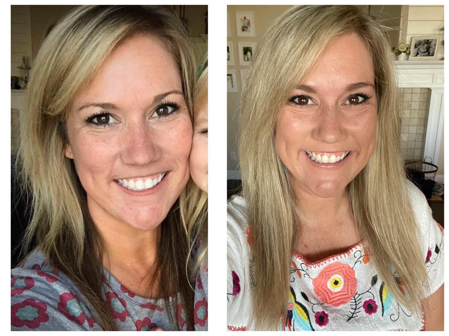 Hair System