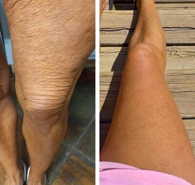Cellulite Firming Cream