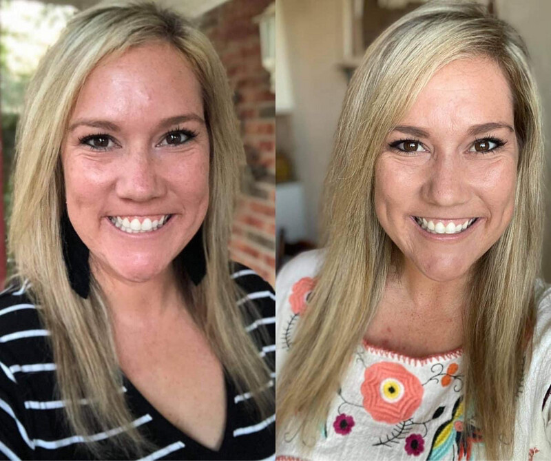 ageLOC Scalp and Hair Serum