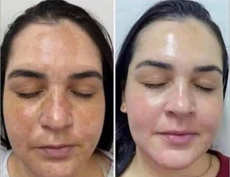 180 Vitamin C Face Wash