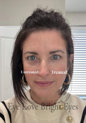 Eye Love Bright Eyes