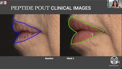 Lip Peptide Pout