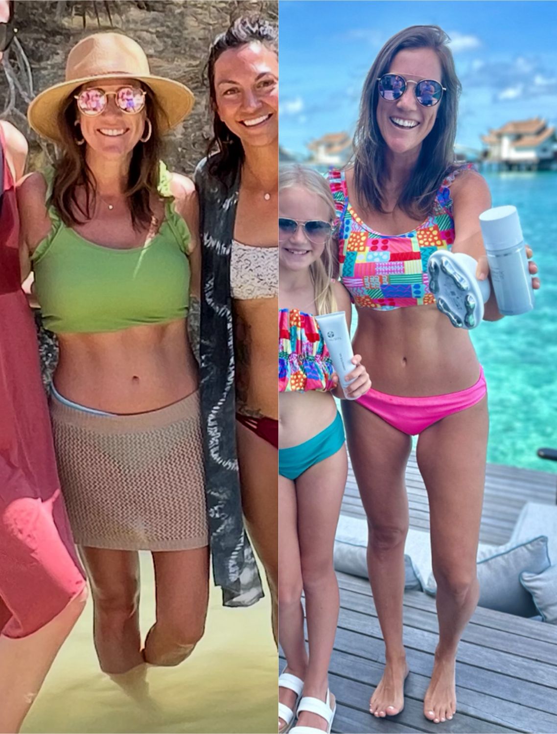 Body Contouring Device