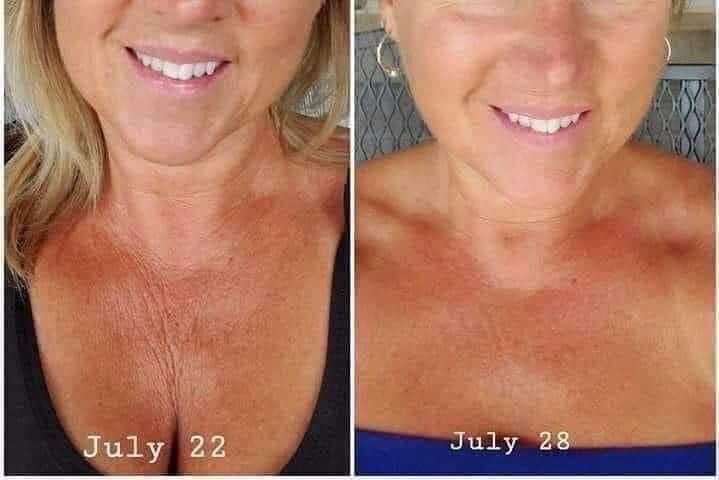 Cellulite Firming Cream