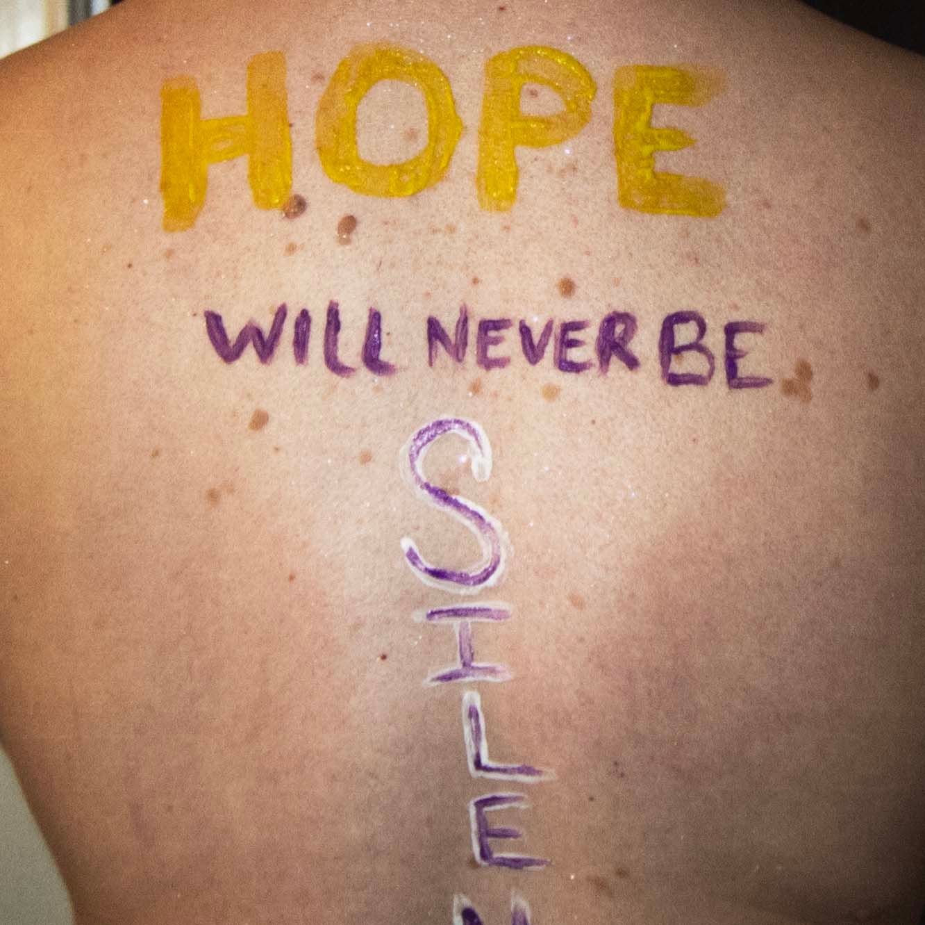 Hope Will Never Be Silent, large photo print BALR04