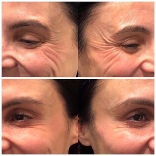 ageLOC® Tru Face® Essence Ultra Uplifting Cream