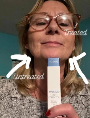 Tru Face® Line Corrector