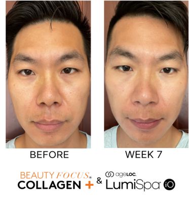 LABOR DAY SALE🇺🇸-Liquid Collagen