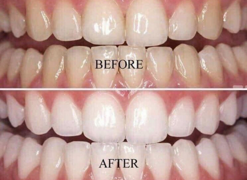 Whitening Toothpaste
