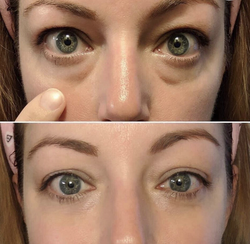 Ideal eyes