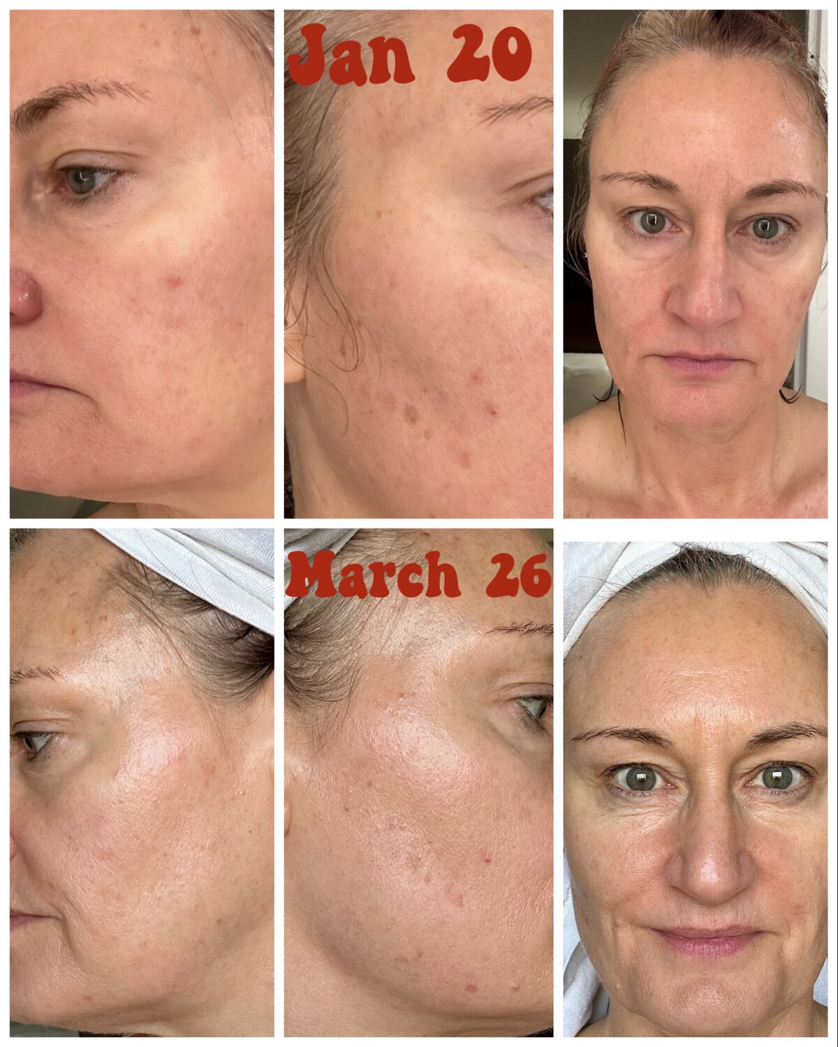 Vit C/Vegan Collagen Pump