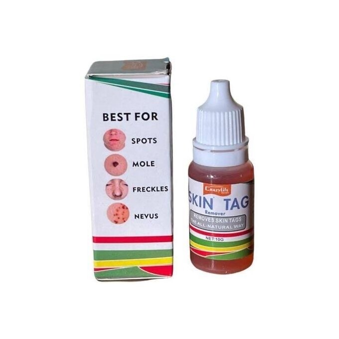 Skin Tag Remover