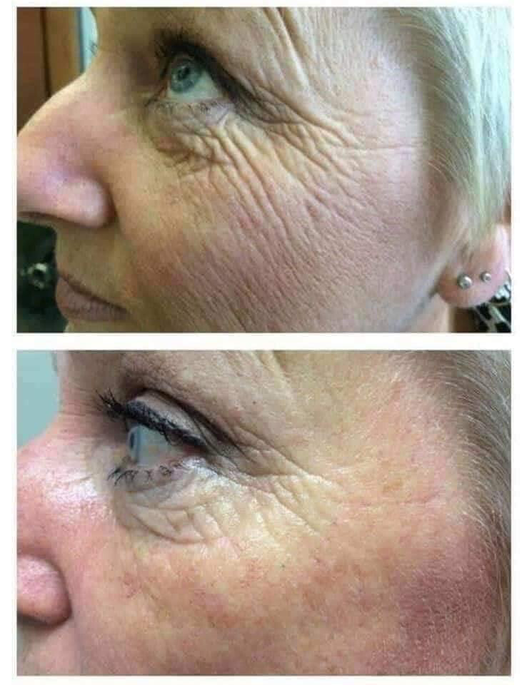 AgeLOC Uplifting Cream