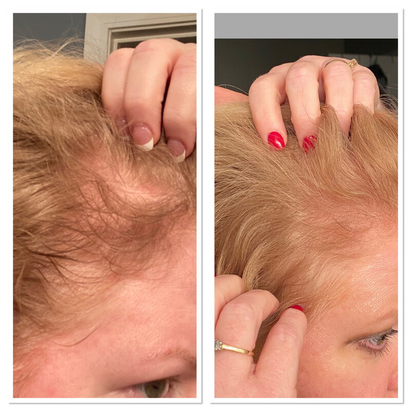AgeLOC Hair and System &lt;Shampoo, Conditioner &amp; Leave In Scalp Spray&gt;