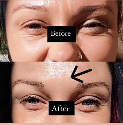Line Corrector