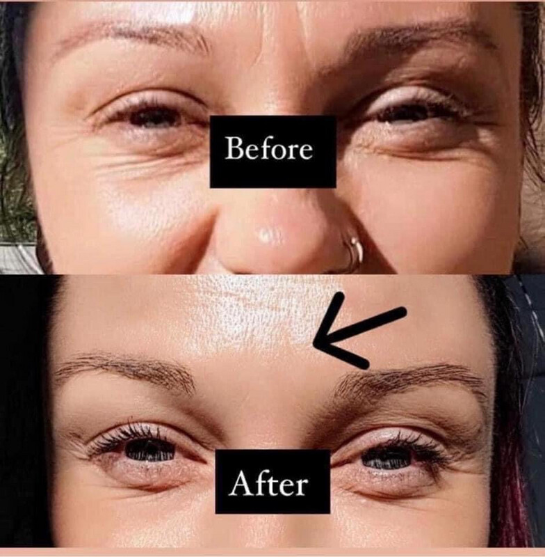 Line Corrector
