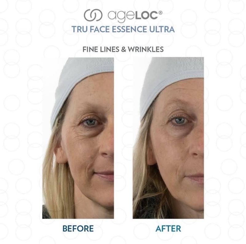 TFEU ageLOC Serum Capsules