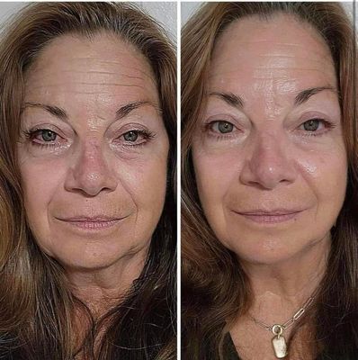 Retinol Peptide