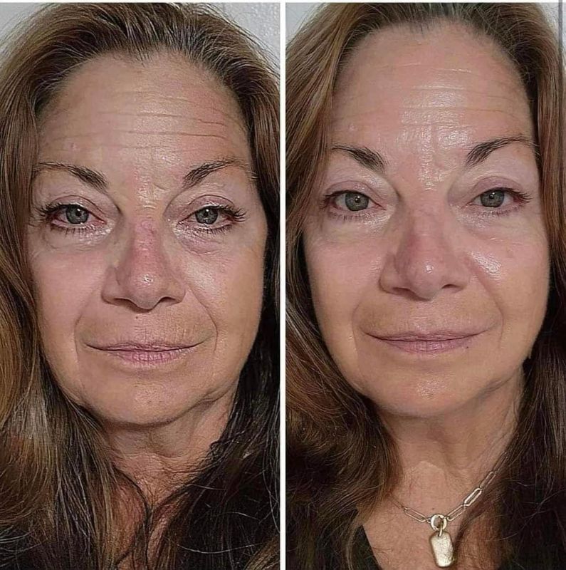 Retinol Peptide