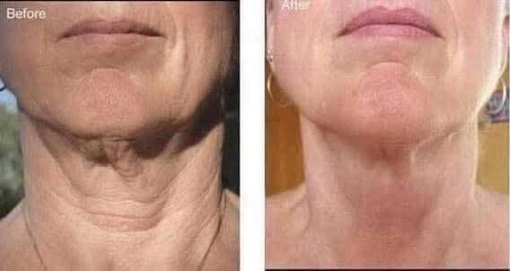Firming Lotion