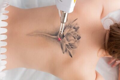 Pico CO2 YAG Laser