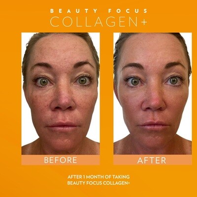 Collagen