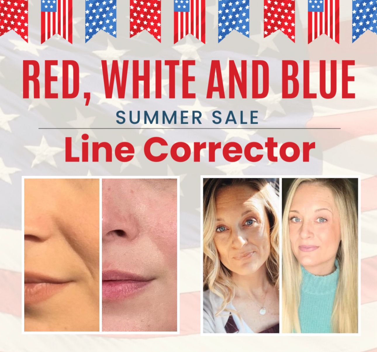 Line Corrector