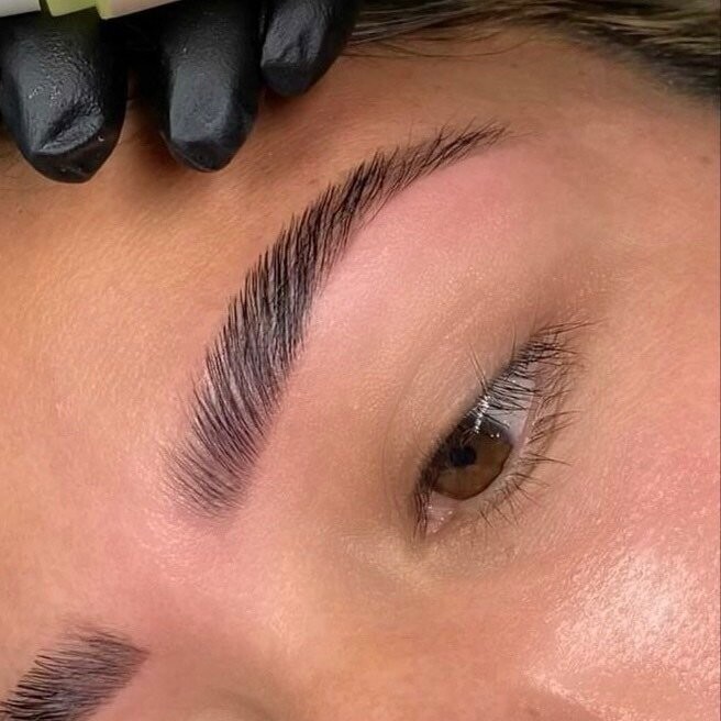Browlift
