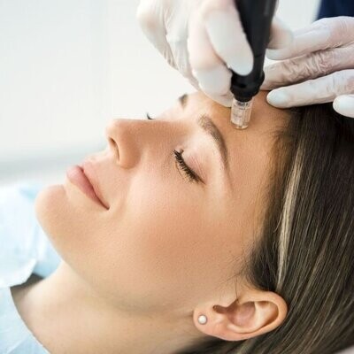 Microneedling