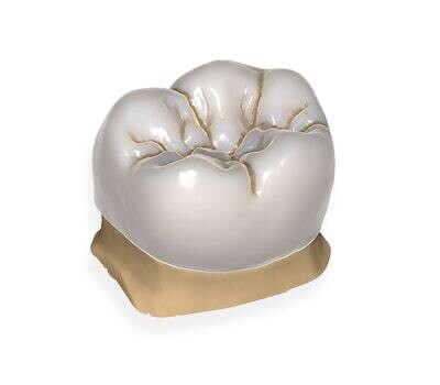 Anatomic Crowns