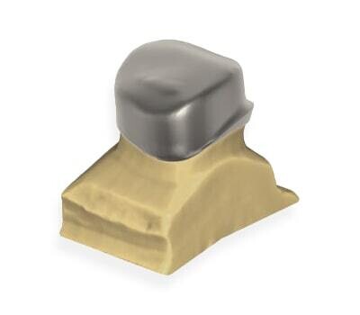 Telescopic Crowns