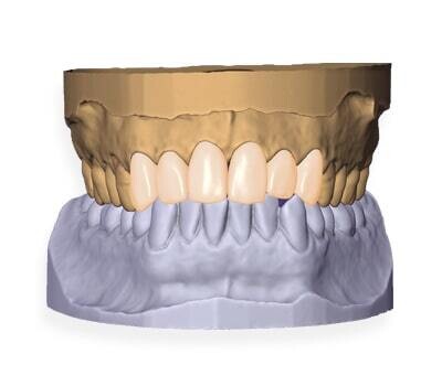Smile Design