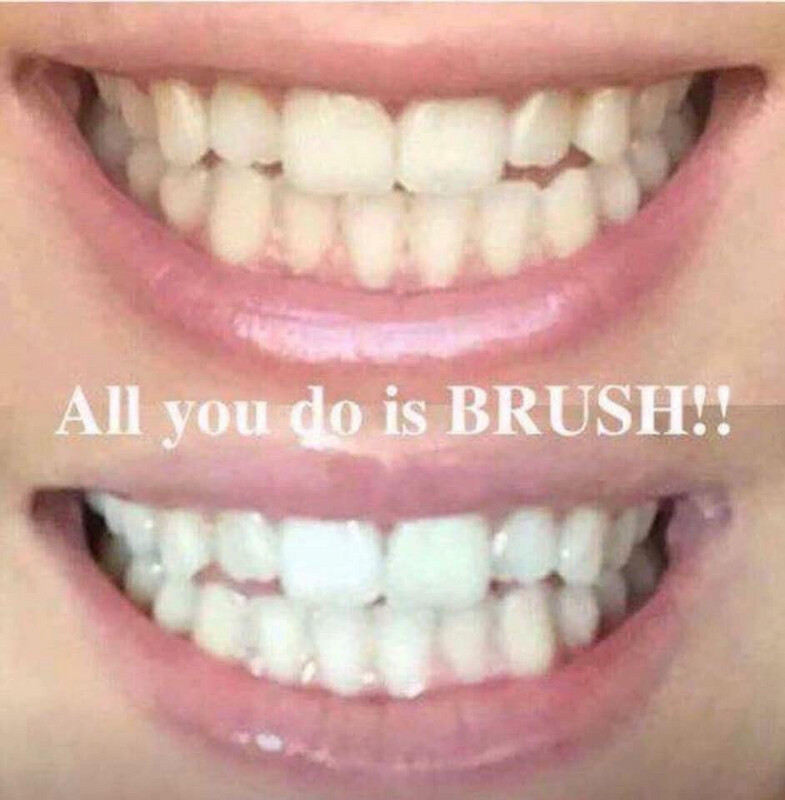 Whitening Toothpaste