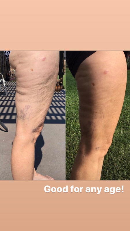 Cellulite Cream (Dermatic Effects)