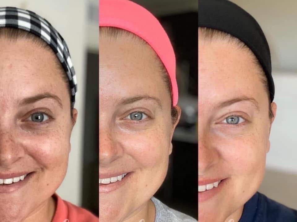 180 AHA Facial Peel + Neutralizer (18 pads)