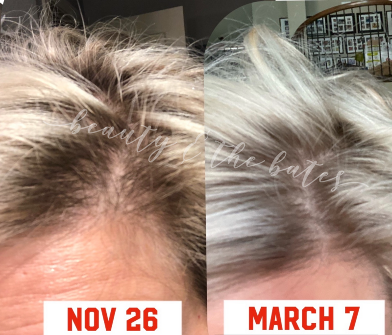 Scalp &amp; Hair Treatment